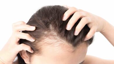 درمان جدیدی برای رشد مجدد مو در بیماران خودایمنی