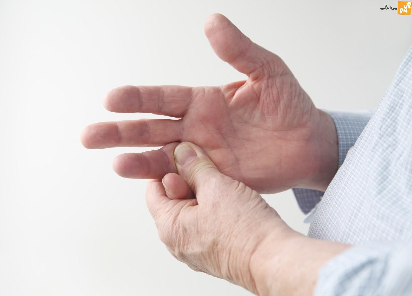سوزن سوزن شدن دست ها ممکن است از علائم این بیماری ها باشد! /جزئیات