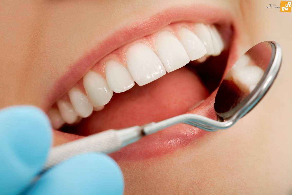 محققان ژاپنی و دارو برای رشد مجدد دندان های انسان!