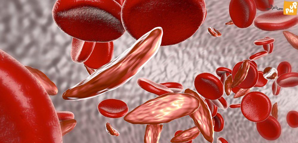 6 راه برای درمان کم خونی!
