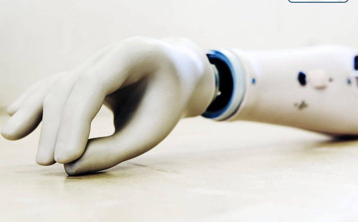 تولید دست مصنوعی با استخوان و تاندون برای بار اول در جهان + تصویر