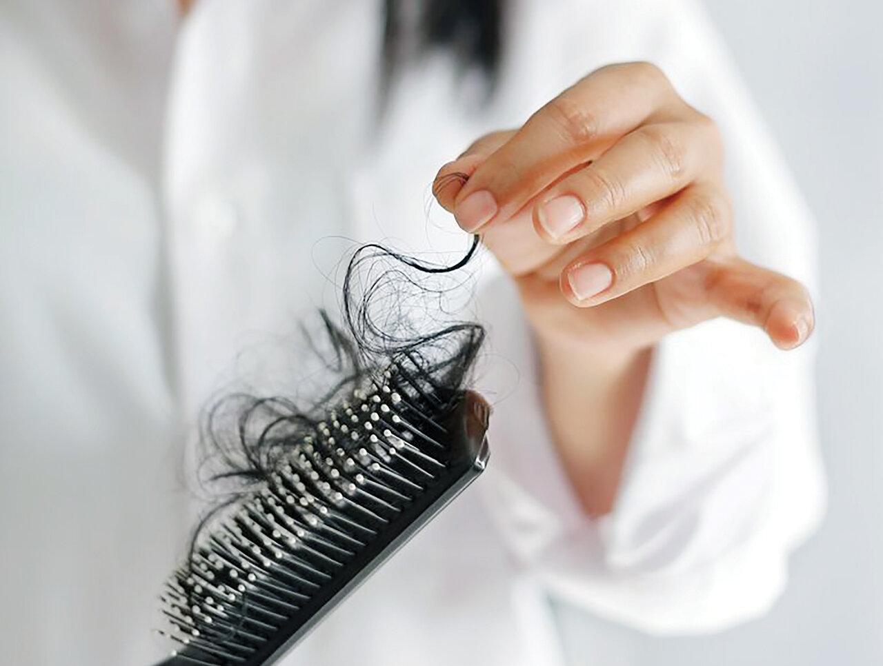با انجام این سه کار از ریزش مو در زنان جلوگیری کنید