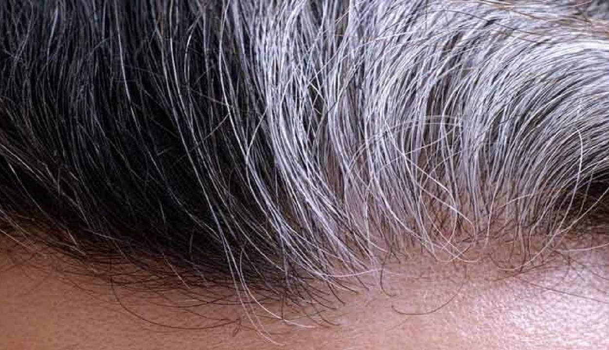 کدام ویتامین ها ریزش موی تیروئید را متوقف می کنند؟