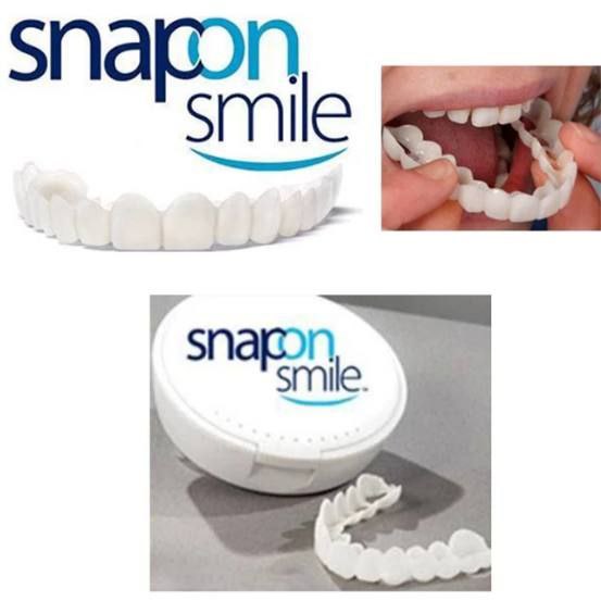 بررسی و انتخاب لمینت دندان متحرک Snap-on-Smile