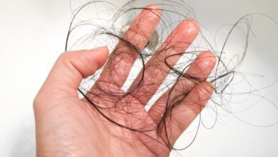 روش های پیشگیری و جلوگیری از ریزش مو، ابرو و مژه