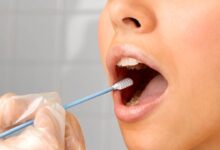 تشخیص این سرطان کشنده با شستشوی دهان در مطب!