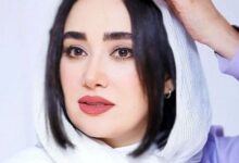 تغییرات عجیب چهره بهاره افشاری بازیگر معروف در ۴۰ سالگی + عکس