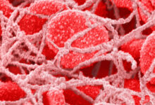 میکروپلاستیک ها در لخته شدن خون نقش دارند!