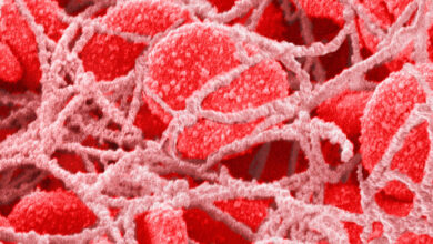 میکروپلاستیک ها در لخته شدن خون نقش دارند!