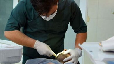 پوسیدگی دندان در کودکان و بزرگسالان؛ هزینه بالا، مانع درمان به موقع