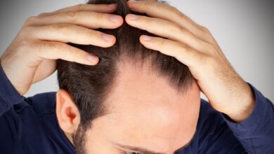 4 عامل اصلی ریزش مو را بشناسید