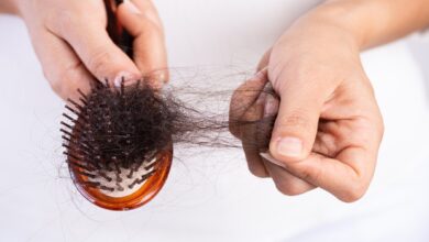 مهمترین عوامل ریزش مو در زنان