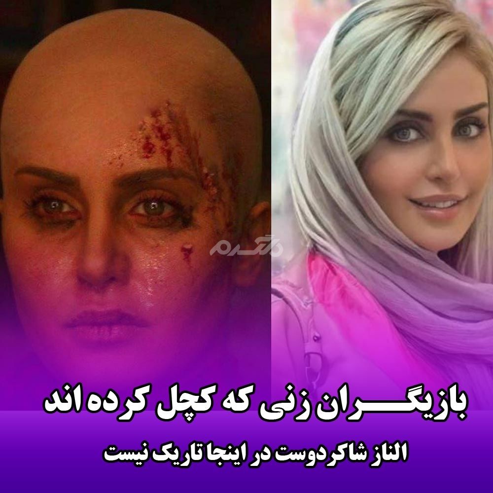 8 بازیگر زن جذاب سینمای ایران که خود را کچل کردند+ تصاویر قبل و بعد