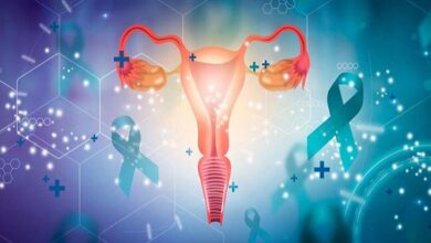 خطر سرطان تخمدان در زنان مبتلا به اندومتریوز چهار برابر بیشتر است