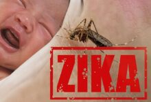 زنگ خطر برای نوزادان مبتلا به زیکا؛ آسیب طولانی‌مدت به سیستم ایمنی