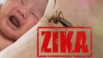 زنگ خطر برای نوزادان مبتلا به زیکا؛ آسیب طولانی‌مدت به سیستم ایمنی
