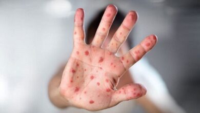 شیوع بیماری سرخک در عراق/ واکسیناسیون قبل از شرکت در مراسم اربعین ضروری است