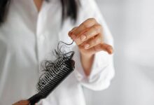 غذاهایی که باعث ریزش مو می شوند / راه هایی برای کاهش ریزش موی ناشی از افزایش سن
