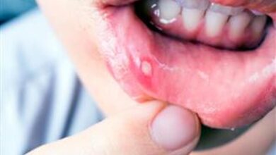 چرا دچار دهان درد می شویم و چگونه آن را درمان کنیم؟