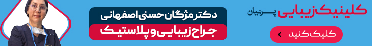 رندار  