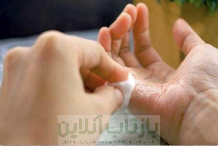 نحوه پاک کردن چسب ؛ از پوست و سطوح مختلف [پلاستیک، فلز، شیشه]