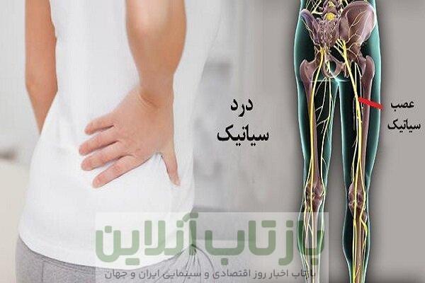 سیاتیک را با گرفتگی عضلات اشتباه نگیرید