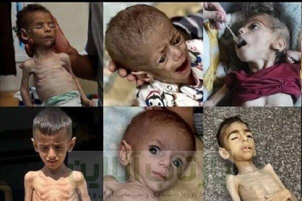 غزه زیر آتش و گرسنگی؛ صف‌های غذا به قربانگاه تبدیل می‌شوند