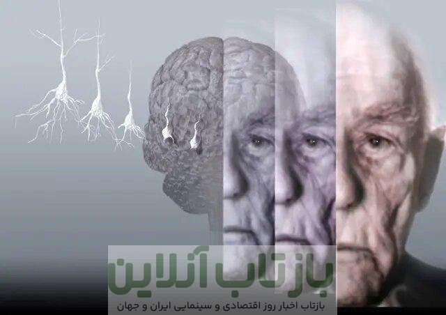 فرمول پیشگیری از آلزایمر