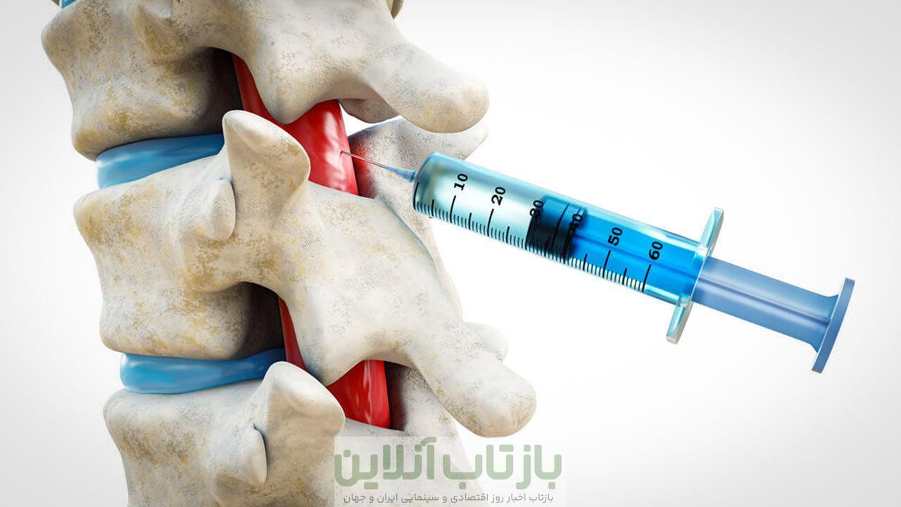 روشی نوین محققان ایرانی برای ترمیم ضایعات نخاعی