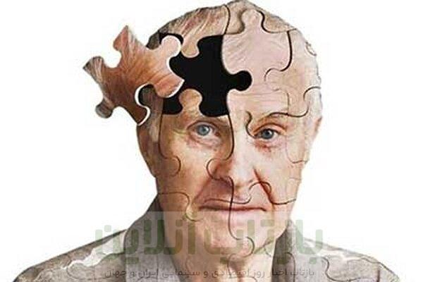 آلودگی هوا می‌تواند روند پیشرفت آلزایمر را تسریع کند