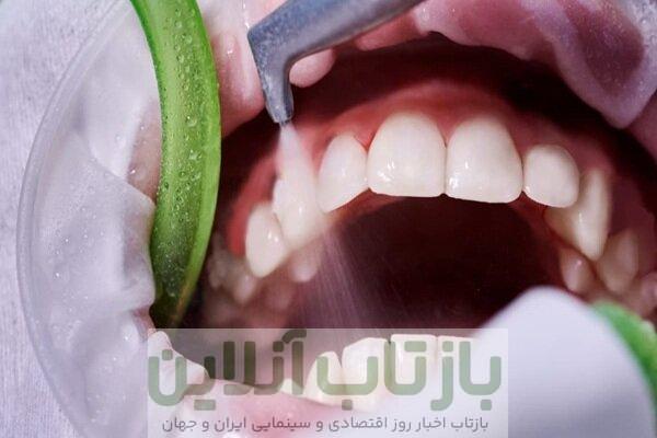 ضرورت سلامت دهان و پیشگیری از بیماری‌های لثه‌ای