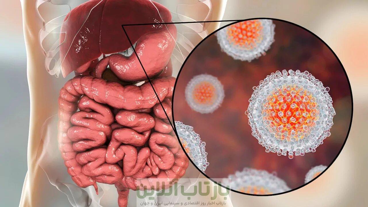 شیوع هپاتیت A در جمهوری چک جان ۱۰ نفر را گرفت