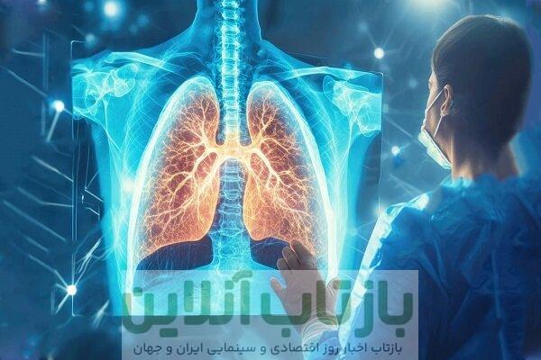«سل» هنوز در کشور وجود دارد اما کاملاً قابل درمان است