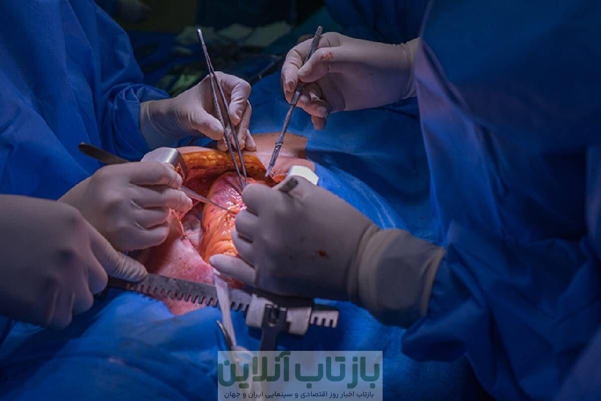 آیا امکان پیوند قلب از جسد در ایران فراهم است؟