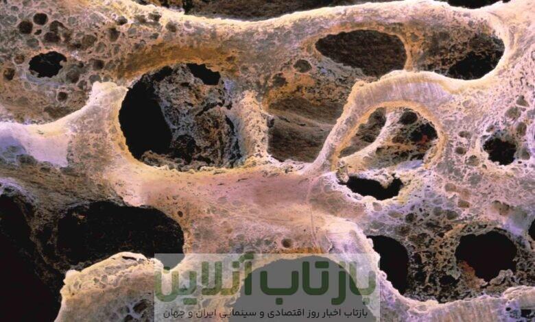هشدار؛ ابتلای ۳۰ درصد از زنان بالای ۵۰ سال به پوکی استخوان