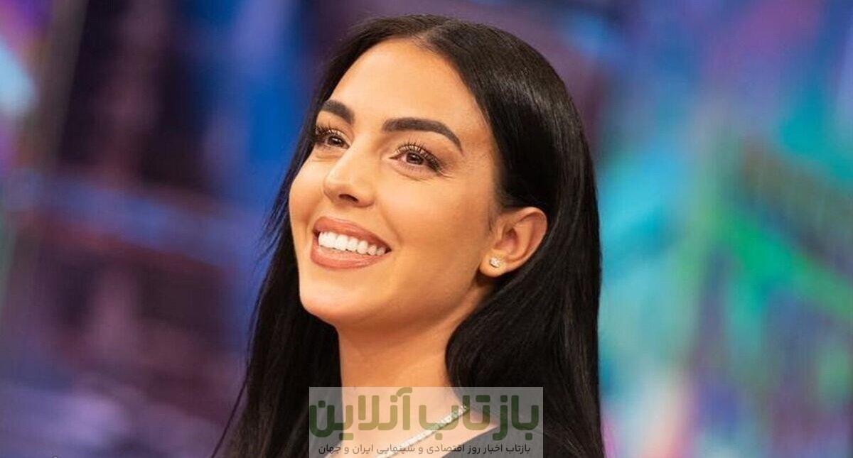 عکس| جورجینا قبل و بعد از عمل