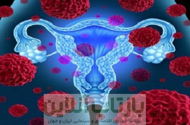 کشف عامل جدید گسترش سرطان تخمدان