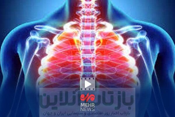 وقتی پاییز ریه‌هایمان را تهدید می‌کند