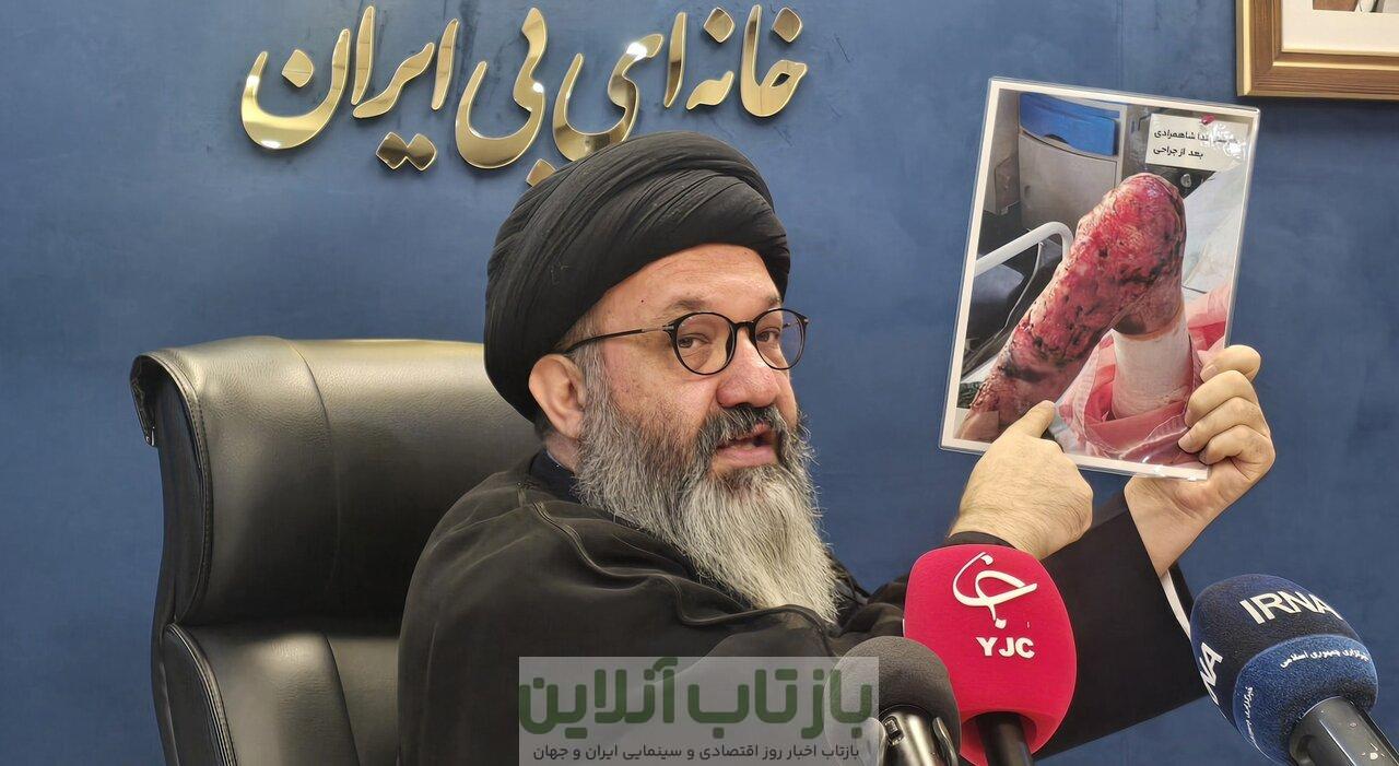 حدود ۱۲۵۰ بیمار «ای بی» در کشور شناسایی شده اند