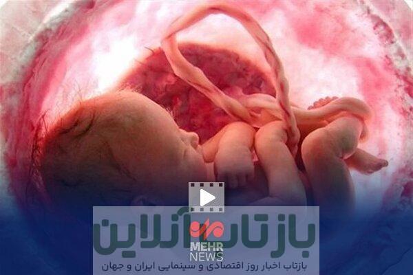 کاهش چشمگیر آمار سقط جنین در کشور با اجرای طرح «نفس»