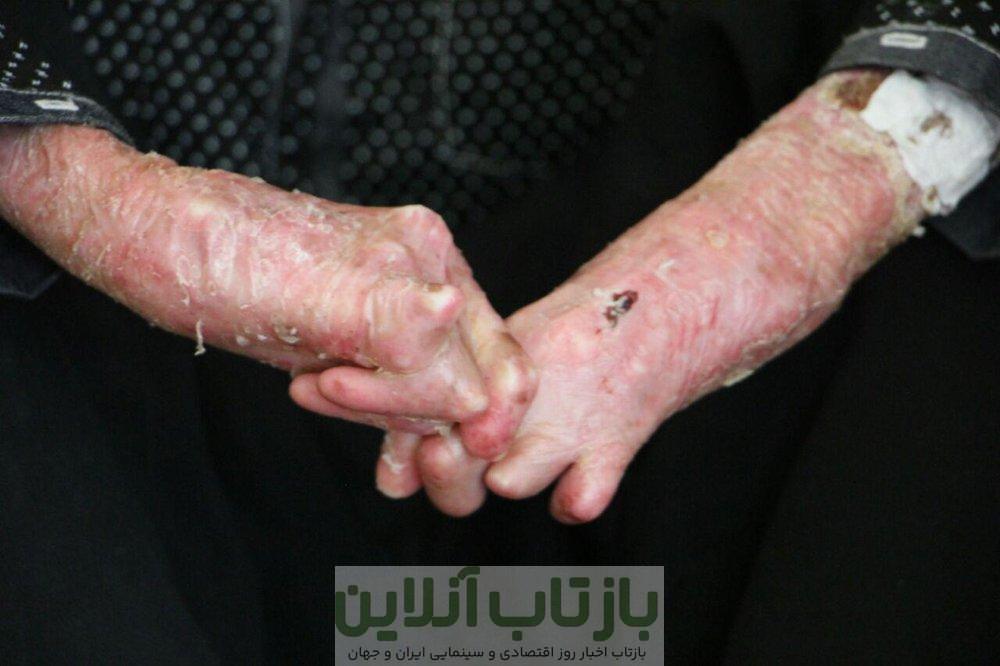 ضرورت اطلاع‌رسانی درباره ازدواج‌های فامیلی و بیماری‌های ژنتیکی