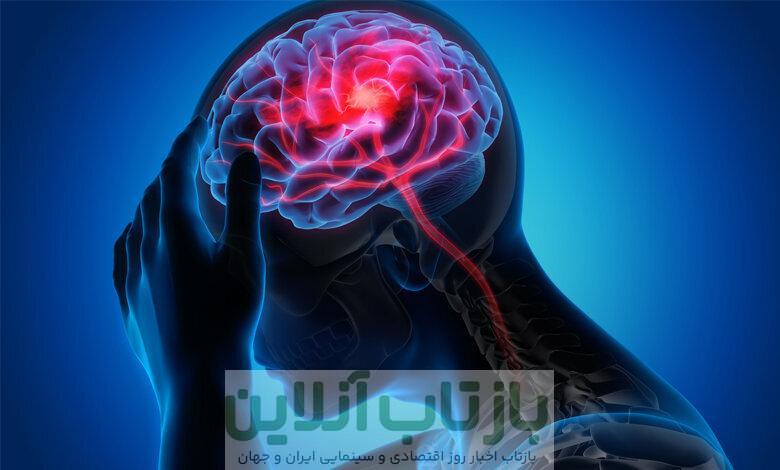 سکته مغزی در ایران دومین علت مرگ‌ومیر است