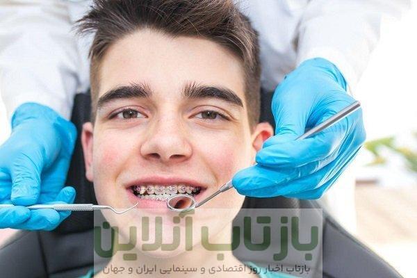 لق شدن روکش دندان می‌تواند نشانه‌ای از پوسیدگی پنهان باشد