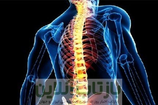 افزایش درد و مشکلات ستون فقرات در نسل جوان
