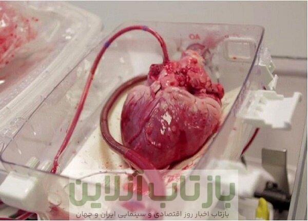 انتقال قلب برای پیوند به نوجوان ۱۵ ساله با اورژانس هوایی