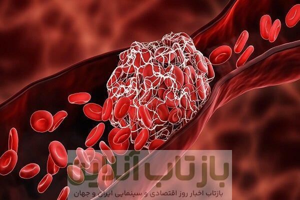 چربی خون بالا؛ دشمن خاموش رگ‌ها