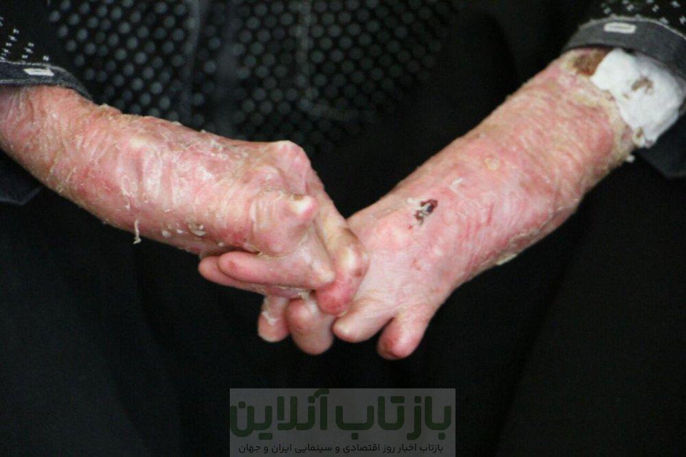 ضرورت اطلاع‌رسانی درباره ازدواج‌های فامیلی و بیماری‌های ژنتیکی